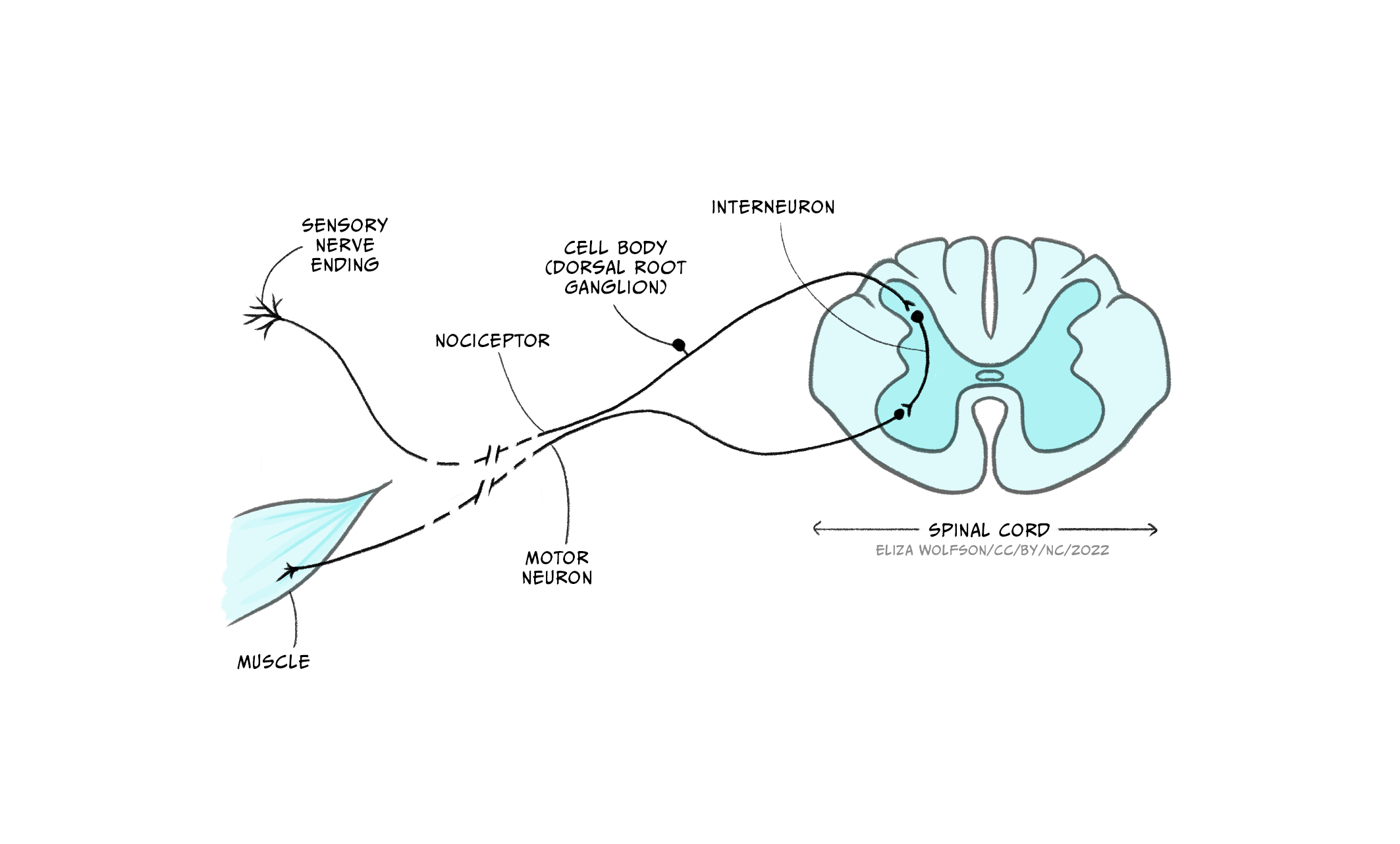 Frontiers  The brain-body disconnect: A somatic sensory basis for