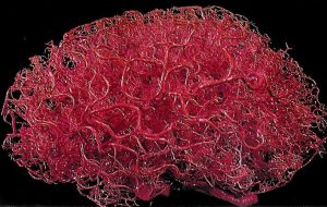 A red plastic cast of the vasculature of the brain, showing its extensive dense complexity