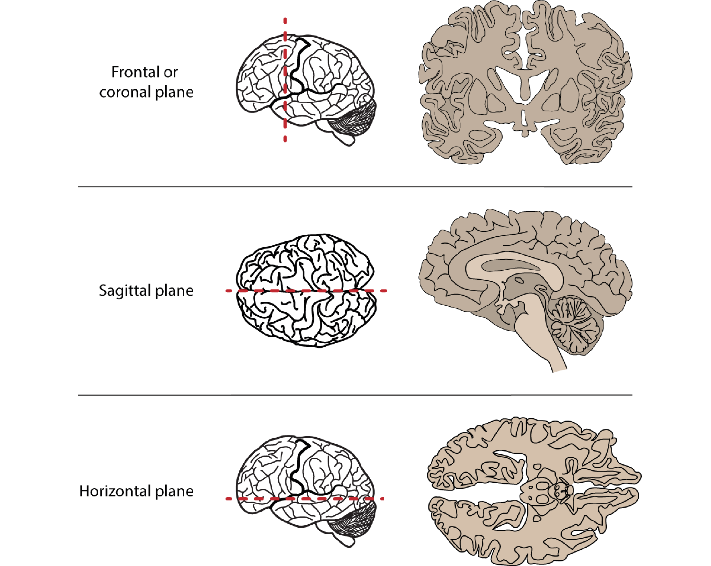 Three anatomical slices of the brain taken along the frontal or coronal plane, the sagittal plane, and the horizontal plane. These 3 line drawings allow us to visualise inside the brain.