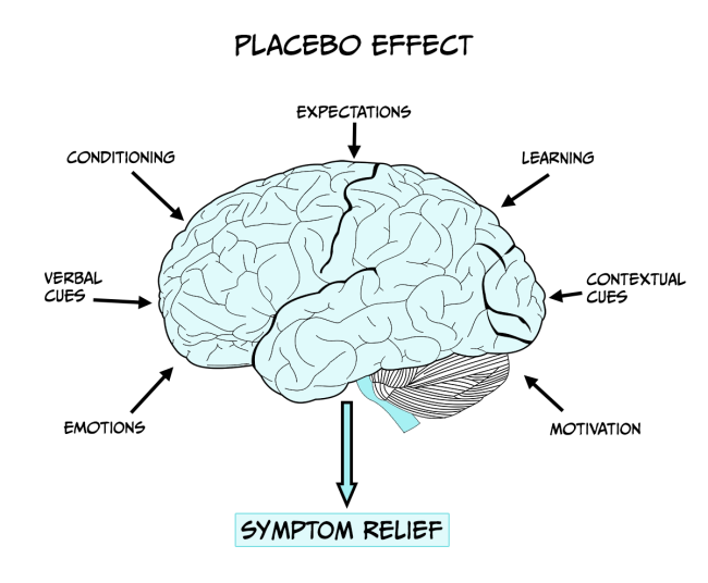 Line drawing of a brain surrounded by labels indicating the psychological influences on the placebo affect, such as expectations, conditioning, verbal cues