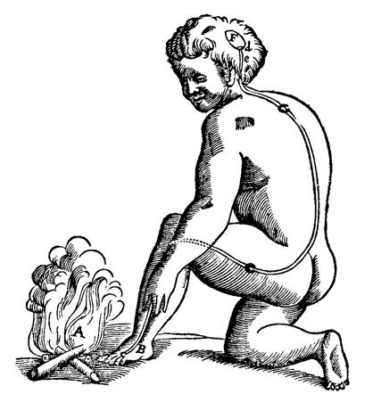 Line drawing of a naked child kneeling by an open fire, labelled A, with a bare foot and hand reaching out to the flames. A line  is drawn from the foot (labelled B) along the thigh and up the spine to the brain (final label F).