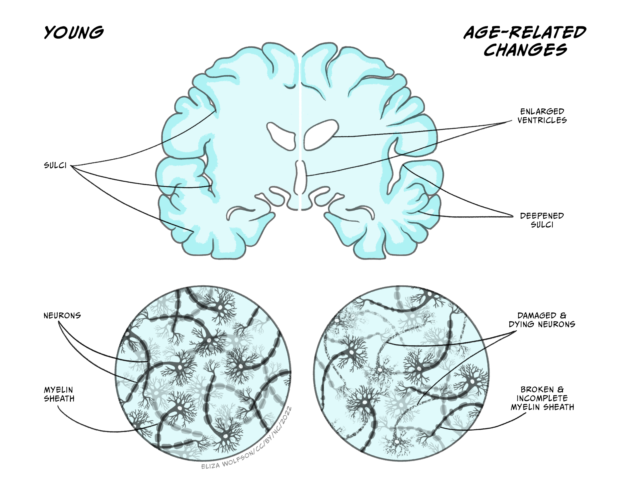 Line drawings showing neuroanatomical changes with ageing from  macro and micro perpectives